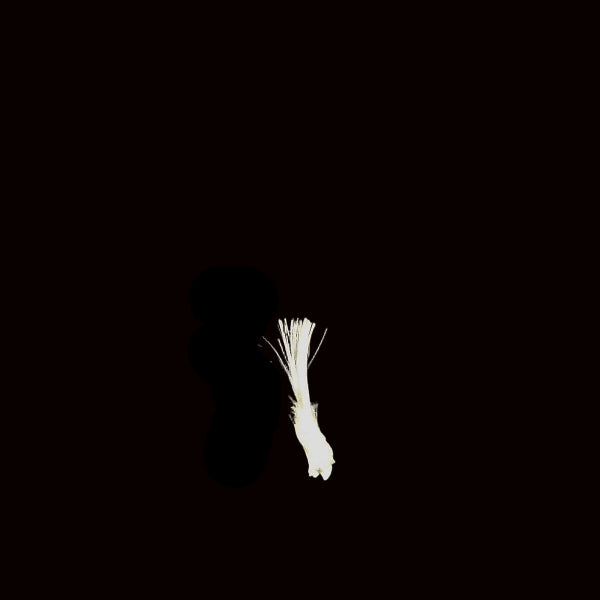 Epsomita